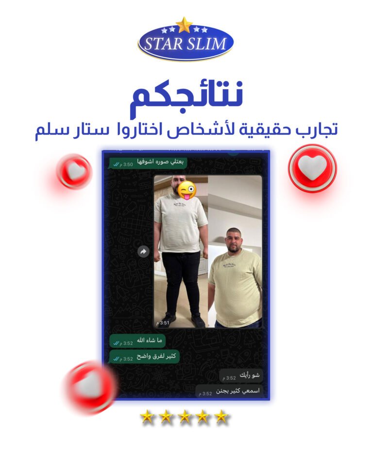 star-slim-feedback-6